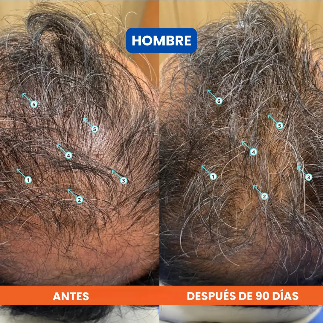 Dúo Rescate Folicular™ (Shampoo Densificador Revita + Suero Roll-On Bodywise)