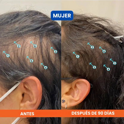 Dúo Rescate Folicular™ (Shampoo Densificador Revita + Suero Roll-On Bodywise)