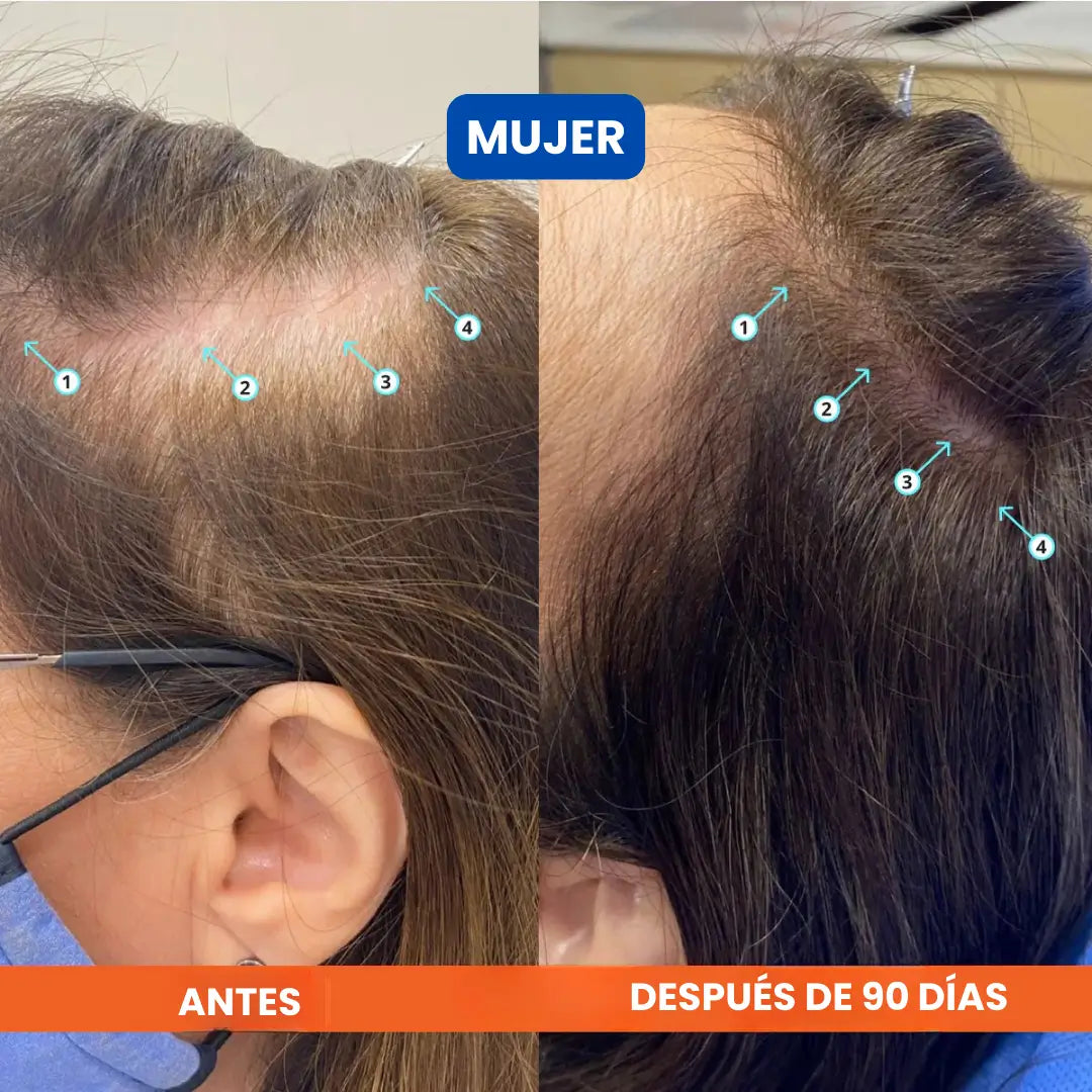 Dúo Rescate Folicular™ (Shampoo Densificador Revita + Suero Roll-On Bodywise)