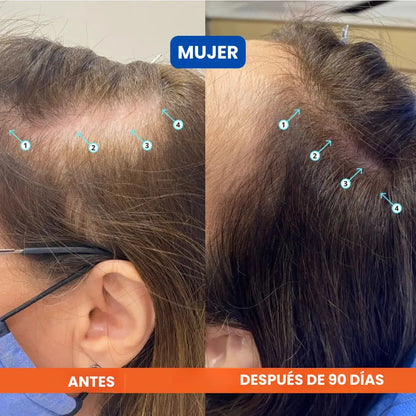 Dúo Rescate Folicular™ (Shampoo Densificador Revita + Suero Roll-On Bodywise)