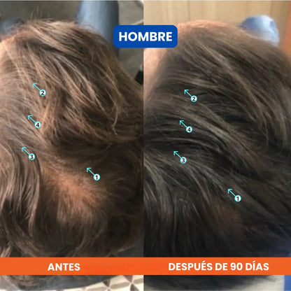 Dúo Rescate Folicular™ (Shampoo Densificador Revita + Suero Roll-On Bodywise)